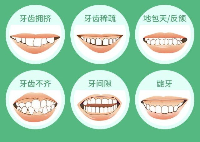 牙齿不整齐的危害